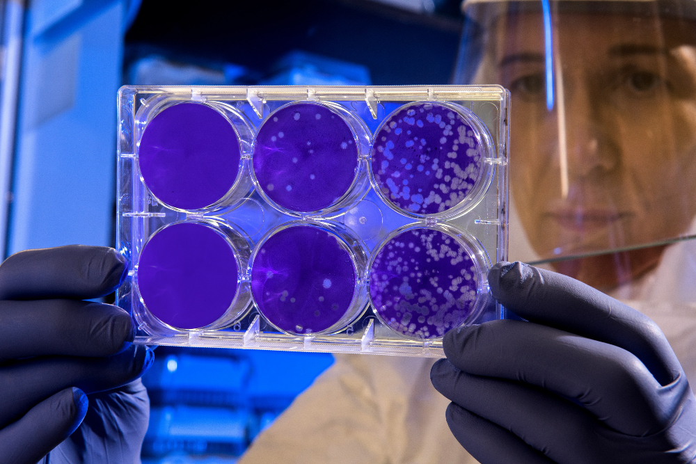 coronavirus italia cdc-unsplash