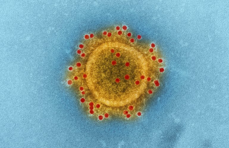 cinco personas coronavirus Foto_ cdc-unsplash