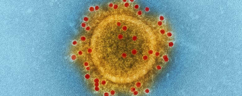 coronavirus-similar-al-vih-foto-cdc-unsplash